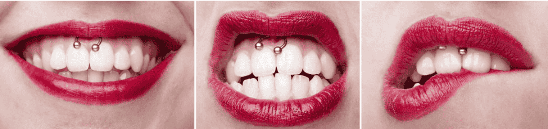 What is a smiley piercing?