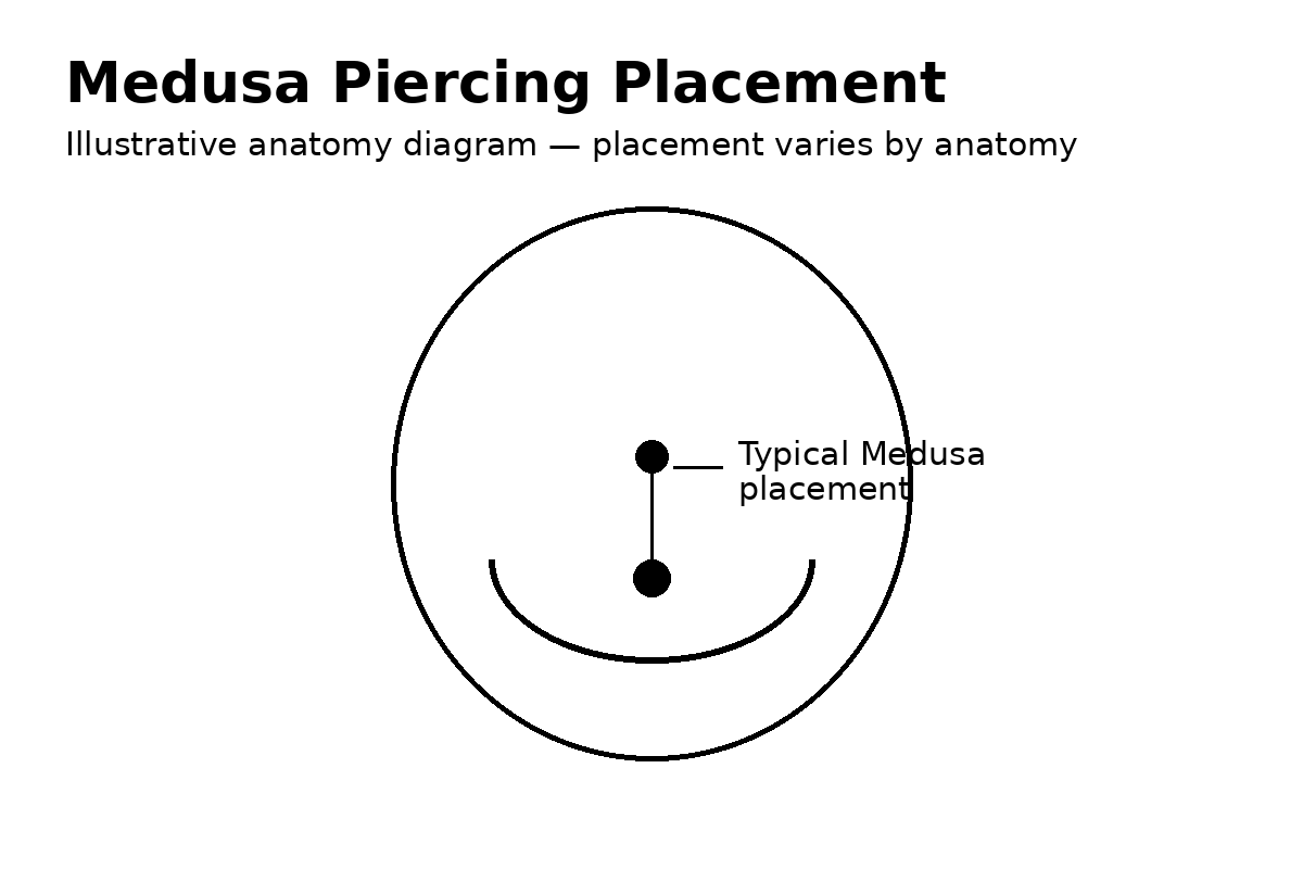 Medusa Piercing Placement and Anatomy