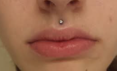 What is a Medusa piercing?