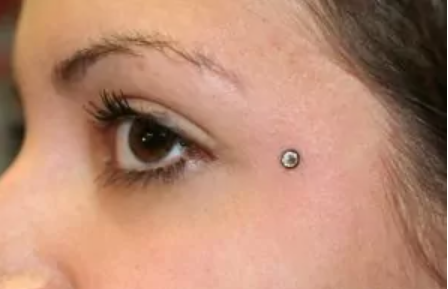 What is a Dermal Anchor, different varients and history